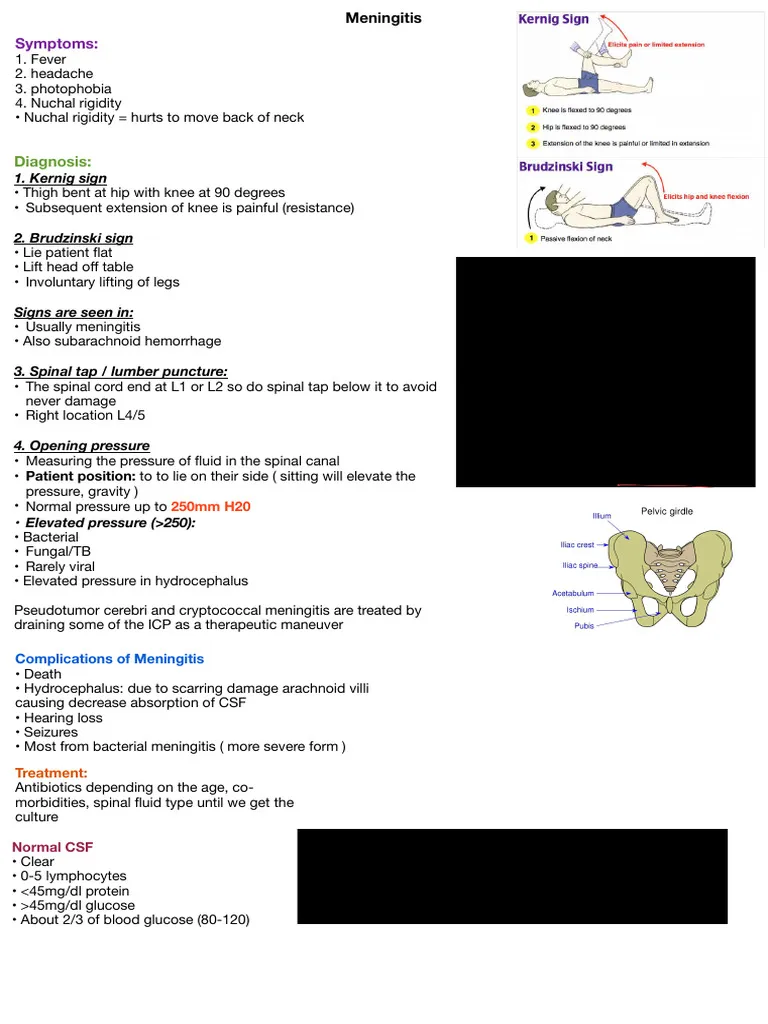 meningitis — ZA news
